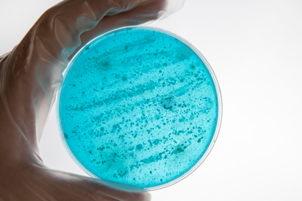 CFA Launches Comprehensive E. coli Intelligence Database to Enhance Food Safety Food and Beverage Business CFA Launches Comprehensive E. coli Intelligence Database to Enhance Food Safety Agriculture, CFA, database, e coli, food safety, industry wide, intelligence database, public health Food and Beverage Business
